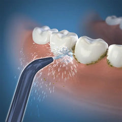 Waterpik™ Handheld Cordless Precision Low-Flow Tip – (JT-360E)