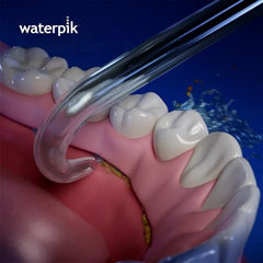 Waterpik™ Implant Denture Tip –  (DT-100E)